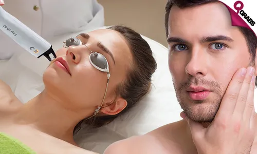 Skin Renewal: Frax Pro Laser for Ladies & Men!
